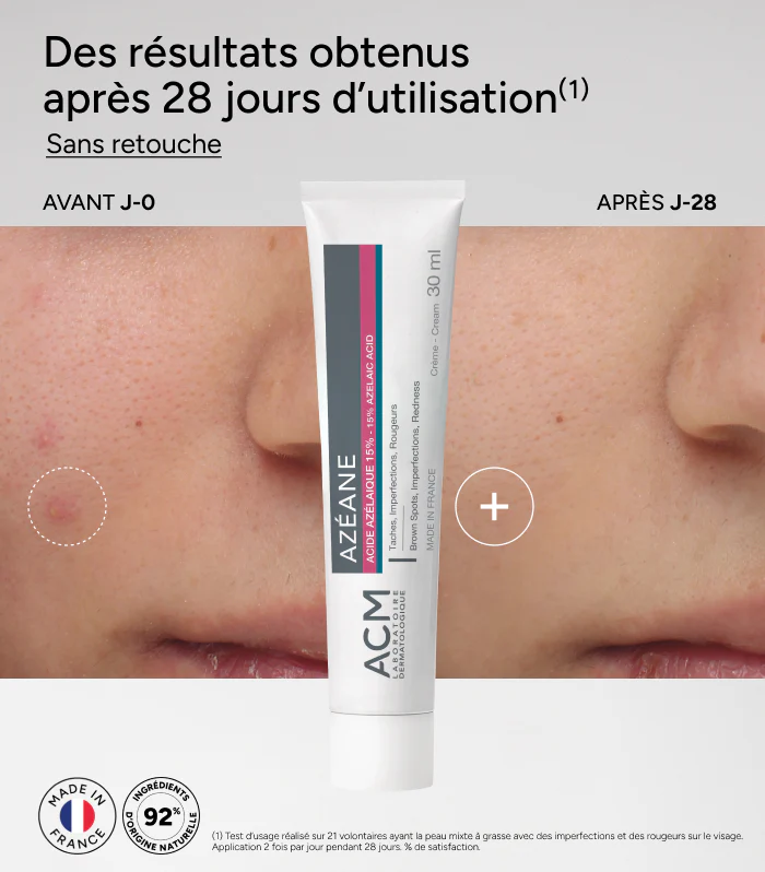 Azéane Crème 15% Acide Azélaïque - Image 7