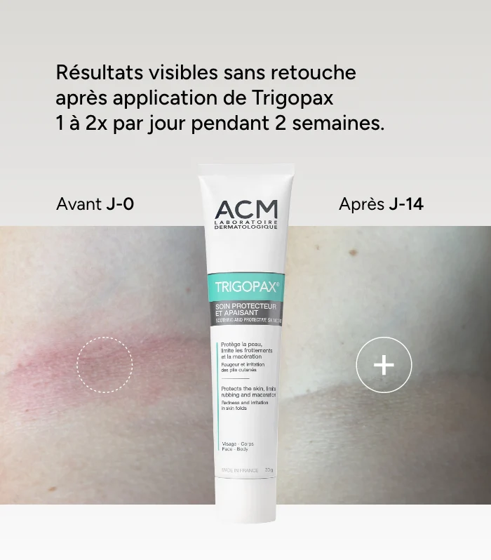 Trigopax Soin Protecteur et Apaisant - Image 7