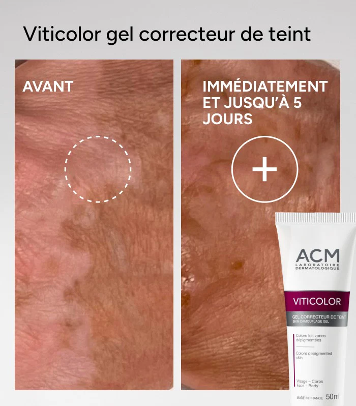 Viticolor Gel Correcteur De Teint - Image 3